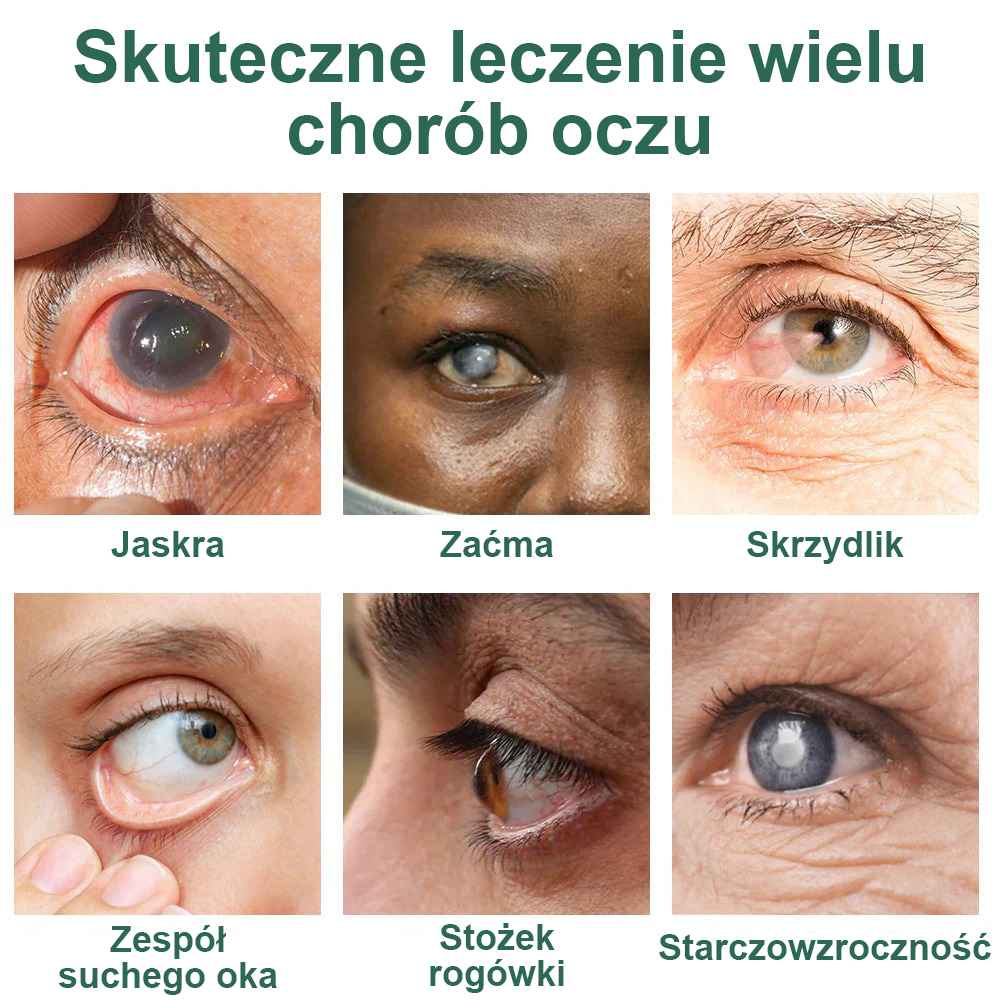 👩⚕️Serum kropli do oczu Ourlyard® Nano ✅Zatwierdzone przez FDA (nadaje się na starczowzroczność, zespół suchego oka, jaskrę i zaćmę) 👀